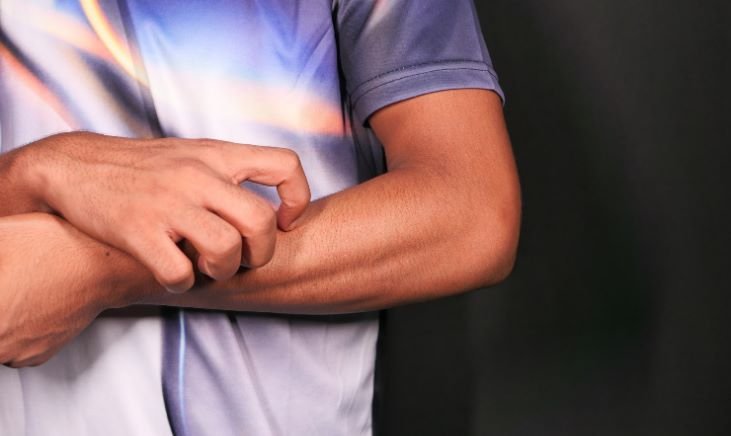 Why-Does-Pre-Workout-Make-You-Itch